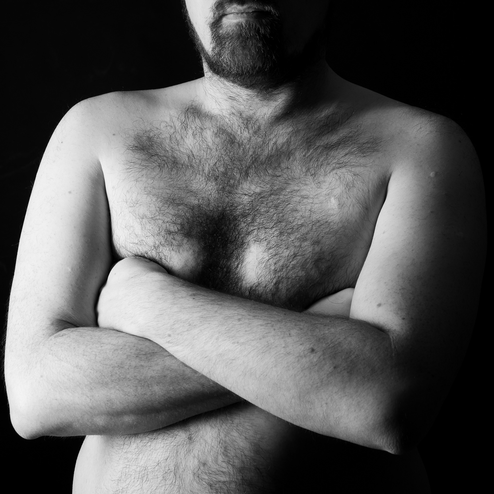 DVT: Shaved chest for ECG II