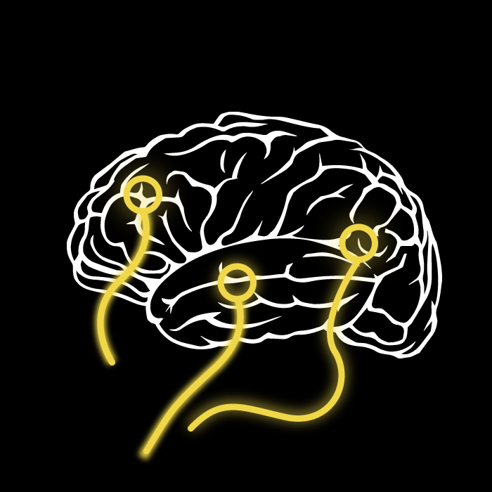 Brain Image