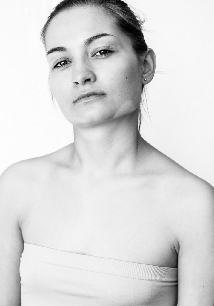 Black and white medium headshot. A woman looks towards the camera at an angle, her chin jutting outward in defiance and eyes confident and challenging. She has a light skin tone with a single triangular patch of vitiligo on her left jawline. Model wears a strapless top and earring studs, her hair tied back into an effortless bun.